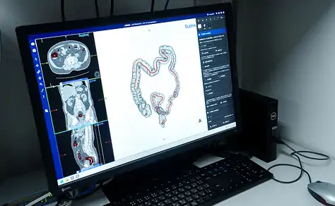3D医用画像処理WS