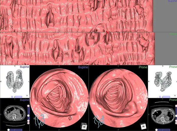 3D画像イメージ