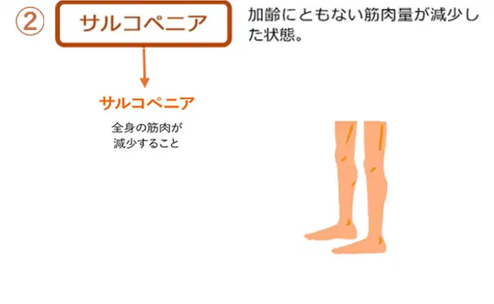 サルコペニアイメージ