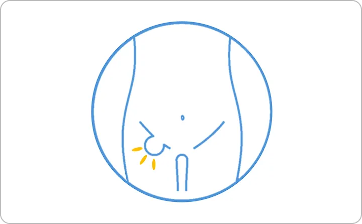 尾張そけいヘルニアセンター