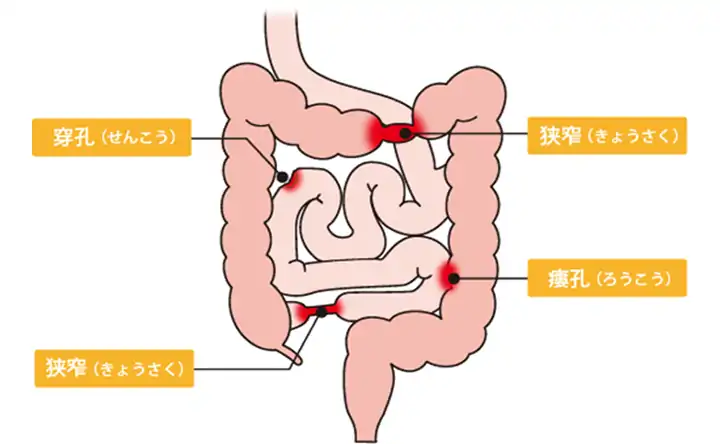 腸イラスト